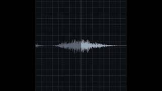 Fine Crackles Recording amp Waveform  Eko Health [upl. by Phelan]