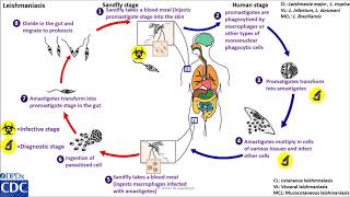 Leishmaniasis anthroponotic life cycle [upl. by Shewmaker]