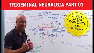 Trigeminal Neuralgia  Causes and Treatment  Part 1 [upl. by Prince]