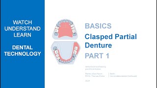 Clasped anchored partial denture  Part 1 [upl. by Simeon]