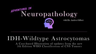 IDH  Wildtype Astrocytoma Update from the 5th Edition WHO Classification of CNS Tumors [upl. by Eedak]