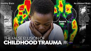 LETS TALK TRUTH  The False Elusion of Childhood Trauma [upl. by Asilanom81]