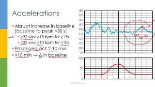 Learn OBGYN Fetal Heart Rate Monitoring  Nonstress Test [upl. by Harat384]