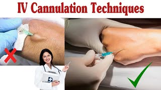 How To Insert IV Cannula  IV Cannulation Techniques [upl. by Maclay579]