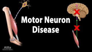 Motor Neuron Disease Animation [upl. by Emogene947]