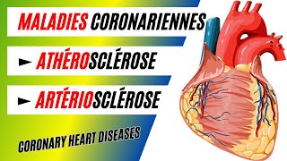 Lathérosclérose et lartériosclérose différence causes et conséquences [upl. by Nyloj]