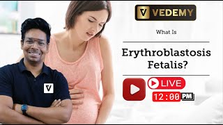 Erythroblastosis Fetalis  Detailed Explanation  Virendra Singh  CSIR  GATE  DBT  ICMR  CUET [upl. by Lewanna]