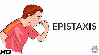 Epistaxis Causes SIgns and Symptoms Diagnosis and Treatment [upl. by Rey]