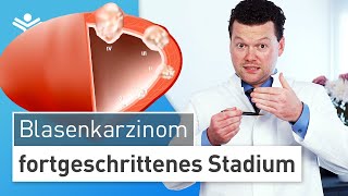 Blasenkrebs im fortgeschrittenen Stadium Wann muss die Blase entfernt werden [upl. by Lock]