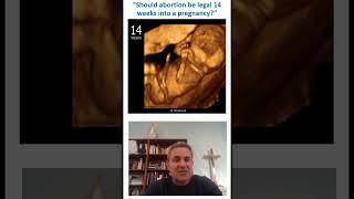 Catholics If you support abortion should there ever be restrictions on abortion short catholic [upl. by Byrd]