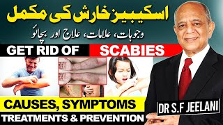 Scabies  Causes Symptoms Treatments amp Preventionखुजलीاسکیبیز کی خارش سے مکمل نجات drjeelani [upl. by Stanleigh]