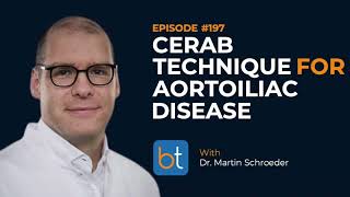 CERAB Technique for Aortoiliac Disease w Dr Martin Schroeder  BackTable Podcast Ep 197 [upl. by Aivila]