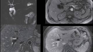 Radiology teaching points 27 Amr Saadawy [upl. by Furnary588]