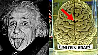 How Einsteins Brain was Different [upl. by God]