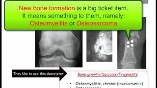 12DaysinMarch Podcast Series Osteomyelitis for the USMLE Step One Exam [upl. by Pilar314]