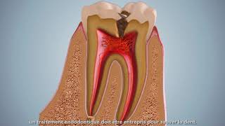 Le Canal Radiculaire dentaire [upl. by Atile]