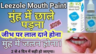 leezole mouth paint how to use Clotrimazole Mouth Paint  leezole [upl. by Nedyaj]