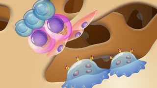 Pathogenesis and Treatment of Myeloma Bone Disease [upl. by Toblat126]