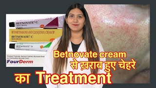 Betnovate c steroid creams side effects  लाल चेहरे का ट्रीटमेण्ट । [upl. by Mapel]