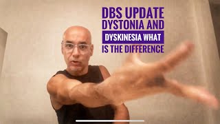 Dbs update dyskinesia and dystonia [upl. by Notlehs]