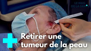 Les prouesses de la chirurgie réparatrice 55  Le Magazine de la Santé [upl. by Ardnohsal755]