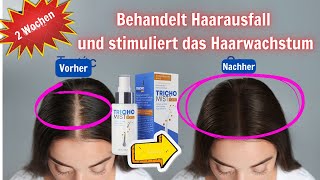 Trichomist Forte Haarausfallbehandlung Ist es gut Anwendung Preis wo kaufen [upl. by Brookes297]