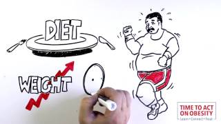 Kevins Obesity Story Ethicon  Whiteboard [upl. by Vashtia]