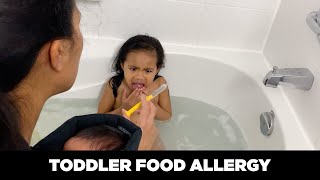 WHAT TO DO  TODDLER FOOD ALLERGY DA CHIN SHOW [upl. by Dew67]