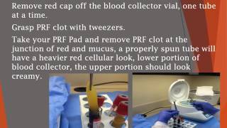 IABDM Presents How Platelet Rich Fibrin PRF Is Made [upl. by Jelena486]