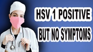 Hsv1 Positive But No Symptoms [upl. by Natsirt]