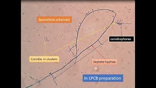 Sporothrix schenckii [upl. by Lauritz]