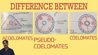 Acoelomates Pseudocoelomates and coelomates  Triploblastic organisation [upl. by Tratner]