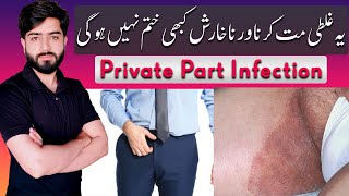 Jock Itch Treatment  Tinea Cruris  Private Part Itch  Babar Ali Hashmi [upl. by Jos]