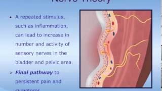 Understanding Interstitial Cystitis ICPainful Bladder Syndrome PBS [upl. by Havot]