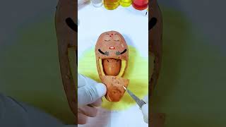 Potato has a Baby Need Emergency Surgery jidoodle fruitsurgery foodsurgery [upl. by Scott]