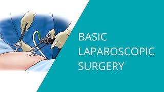 Basic Laparoscopic Surgery [upl. by Eatton98]