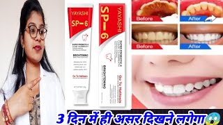 Yayashi Sp 6 Whitening Toothpaste Honest Review yayashi sp6 toothpaste benefits uses review hindi [upl. by Nnilsia]