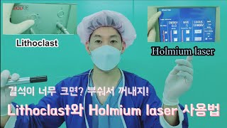 Lithoclast와 Holmium laser 사용법 [upl. by Bryant146]