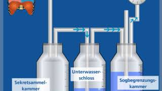 3KammerSystem – Funktionsweise  Thoraxdrainage für Einsteiger [upl. by Esila]