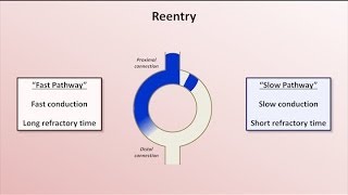 Intro to EKG Interpretation  Mechanisms of Tachyarrhythmias [upl. by Niriam517]