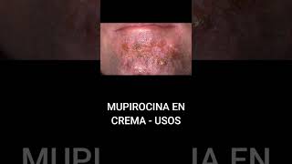 MUPIROCINA EN CREMA  USOS [upl. by Wira]