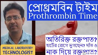 Prothrombin Time International Normalized Ratio PTINR প্রোথ্রমবিন টাইম [upl. by Fionnula569]