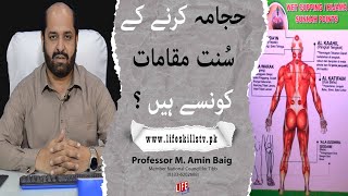 Hijama Sunnah Points  Wet Cupping  MUST WATCH Before Hijama  Lifeskills Tv [upl. by Elias]