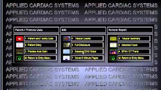 HolterMonitoringcom Holter Monitoring Software Analysis Demonstration [upl. by Inattirb]