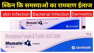 momate f cream  mometasone amp fusidic acid cream uses [upl. by Nosremaj421]