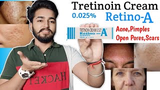 Retino A 0025 Cream Review  Tretinoin Cream Review [upl. by Greenwood]