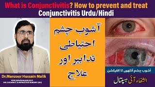 Viral conjunctivitis treatment  How to cure pink eye at home fast  Urdu Hindi [upl. by Areehs]