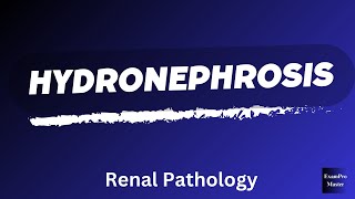 Hydronephrosis  Renal Pathology  Robbins  Easy Explanation [upl. by Fletcher]