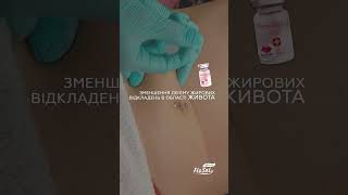 Корекція локальних жирових відкладень в ділянці живота Dermaheal LL мезотерапія [upl. by Akamaozu388]