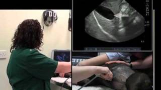 IMV imaging Abdominal Ultrasound Video 4  Ultrasound exam of the liver [upl. by Abbi]